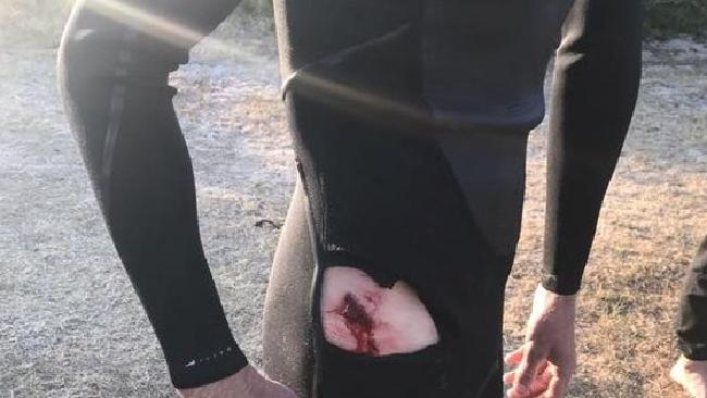 Shark bite pic
