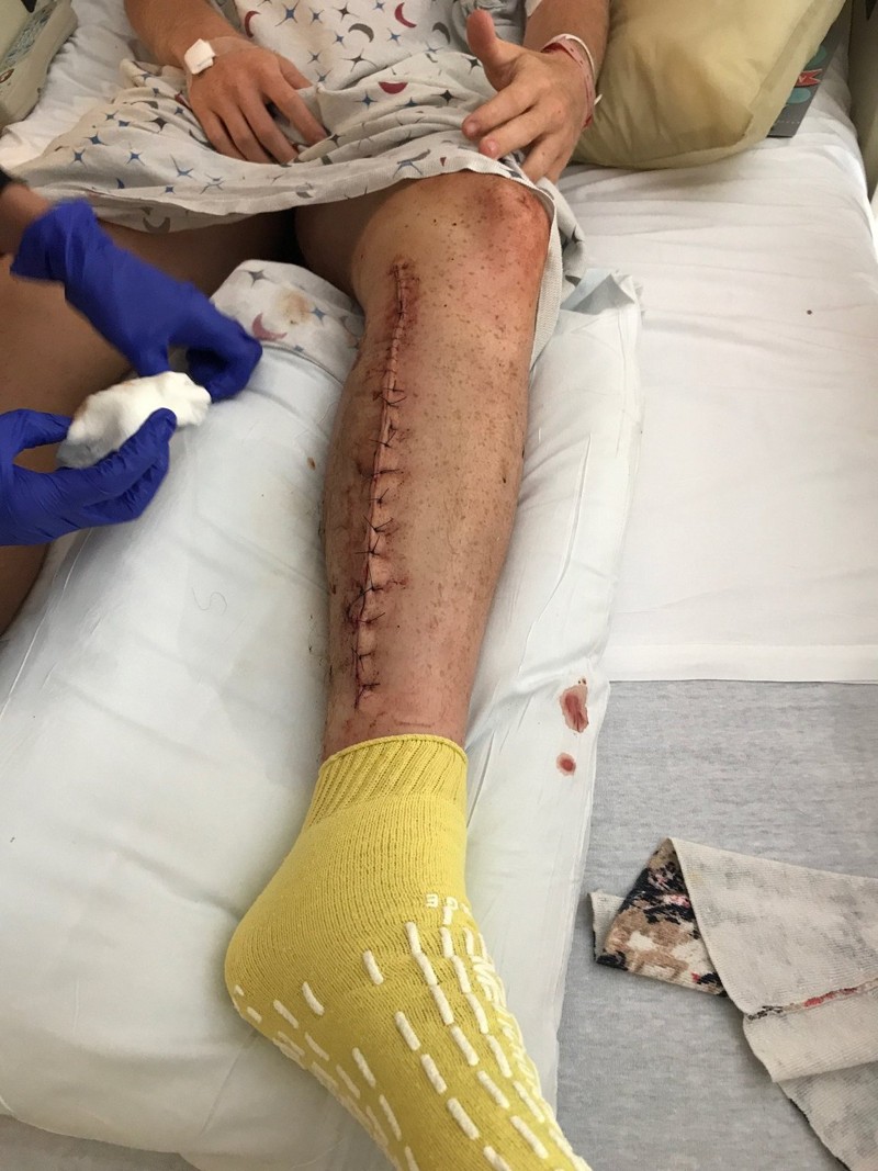 newsEngin.19364230 GoldsteinStingray